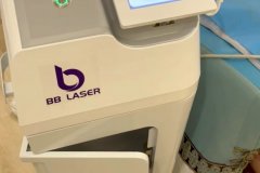 BB laser素顏光國內(nèi)哪個生產(chǎn)廠家比較好？進口素顏光設(shè)備代理商